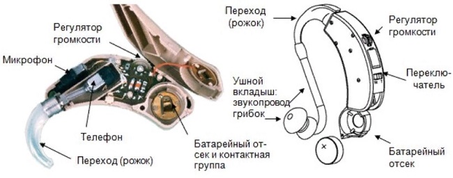 Как устроен слуховой аппарат